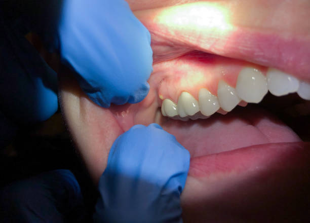 Best Same-Day Emergency Dentist in Holly Springs, MS
