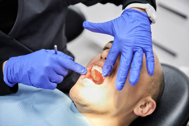 Best Emergency Broken Tooth Repair in Holly Springs, MS
