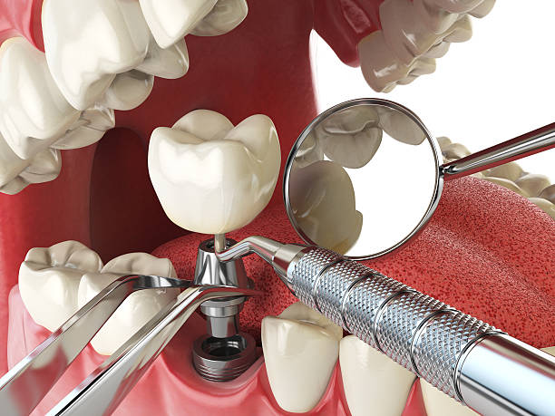 Best Emergency Orthodontic Repairs in Holly Springs, MS
